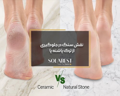 نقش سنگ در جلوگیری از ترک پاشنه پا